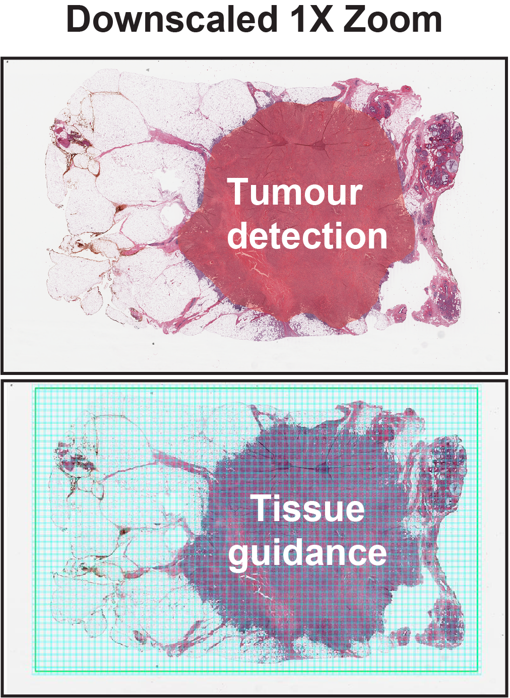 Downscaled 1X overview used for tumour detection and tissue guidance.